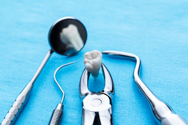 Understanding The Difference Between Direct And Indirect Dental Fillings